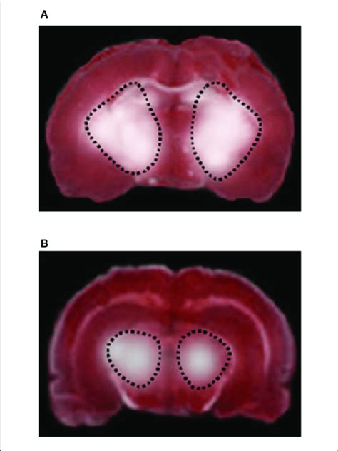 testing rf impact on rat brains|effects of rf on brain.